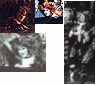 This is not a thumbnail, it doesn't lead anywhere. It's just a collage of very SMALL pictures I've found. ;)